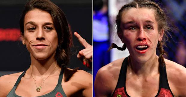 Joanna Jedrzejczyk Acaba Con La Cara Deformada En Una De Las Mejores